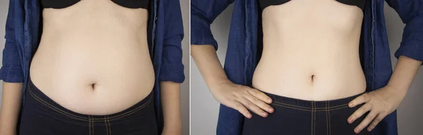 Menina Mostra Resultados Trabalho Corpo Antes Depois Uma Cintura Grossa — Fotografia de Stock