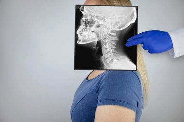 Bir kadının leğen kemiğinin röntgeni. Radyolog röntgen incelemesi yapıyor. Kalça ekleminin bir resmi hastanın vücuduna yerleştirilmiş..