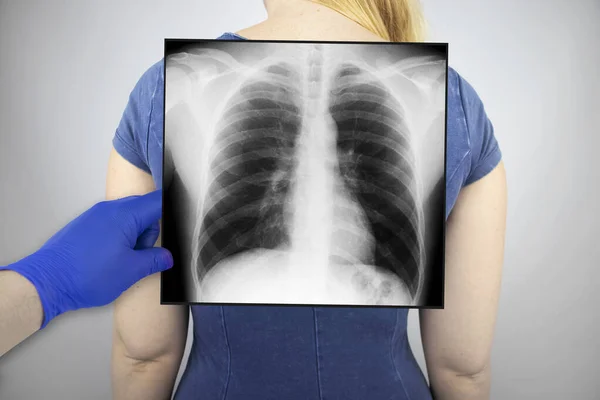 X-ray of the chest of a woman. A doctor radiologist is studying an x-ray examination. A picture of the organs of the chest cavity is attached to the patient's body