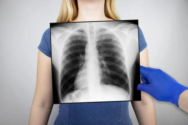 Ray Chest Woman Doctor Radiologist Studying Ray Examination Picture Organs — Stock Photo, Image