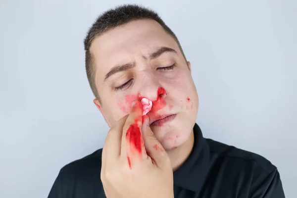 The man has a broken nose after a fight. Blood on hands, cheeks and nose. The consequences of aggressive behavior in men. Attempts to stop the bleeding resulted in blood smearing all over the face.