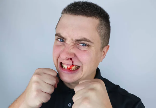 Man Shakes His Fists Shows Aggressive Behavior Has Broken Nose — Stock Photo, Image