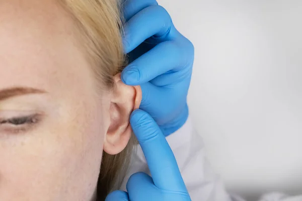 达尔文的结节在耳朵上 在整形外科医生接待处的那个女孩 展示了这个耳廓 — 图库照片