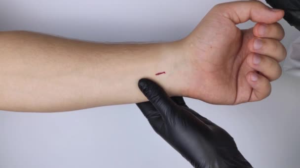 美容外科医は患者の腕にチップを挿入するために小さな切開を行いました バイオテクノロジー 電子文書 技術の未来の概念 — ストック動画