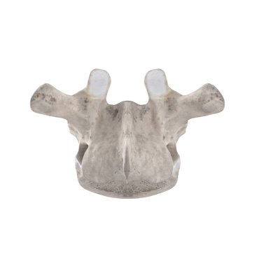 Beyaz posterior görünümde izole edilmiş T3 Torasik vertebra