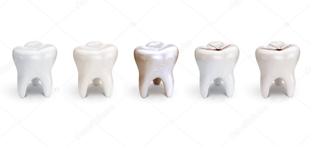 Set of dental care, element for tooth concept. Realistic 3d illustration