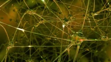 Yapay nedeni. Yapay sinir hücreleri ve sinapslarda bir robot, hangi elektrik darbeleri ve deşarj pass ile beyinde oluşan bir ağ ile yolculuk