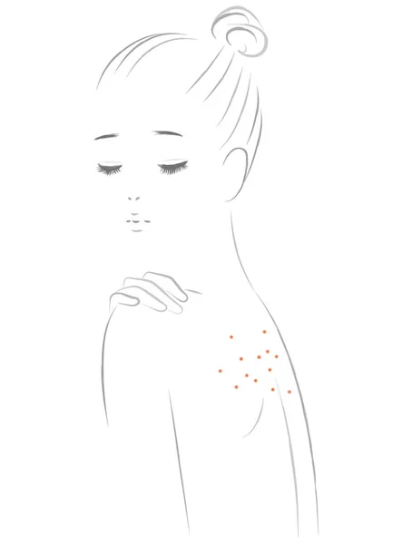 Una Mujer Que Sufre Acné Espalda — Archivo Imágenes Vectoriales