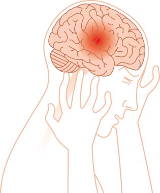 Baş ağrısı ve beyin resim