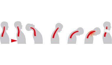 Yan ve boyun yaralanma şok