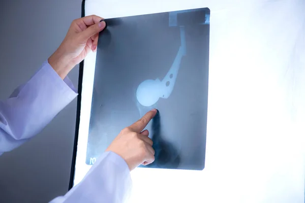 Main Médecin Pointe Vers Film Radiographique Personne Qui Utilise Avec — Photo