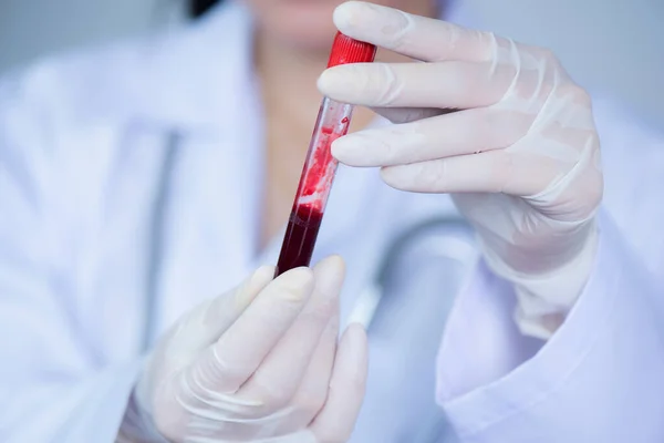 Mão Foco Seletiva Médico Segurando Uma Garrafa Sangue — Fotografia de Stock