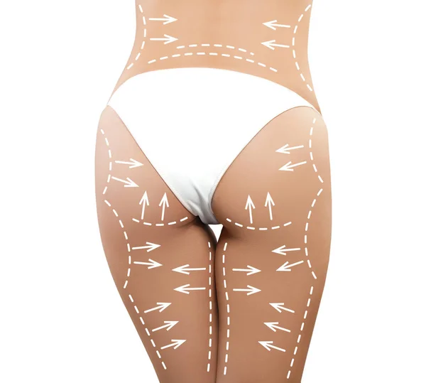 Female body with the drawing arrows. Fat lose, liposuction and cellulite removal concept