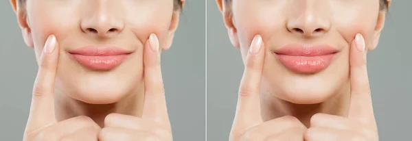 Los Labios Femeninos Mujer Labios Antes Después Las Inyecciones Relleno — Foto de Stock