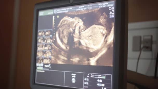 Echografie machine toont een foetus met een gezond kloppend hart — Stockvideo