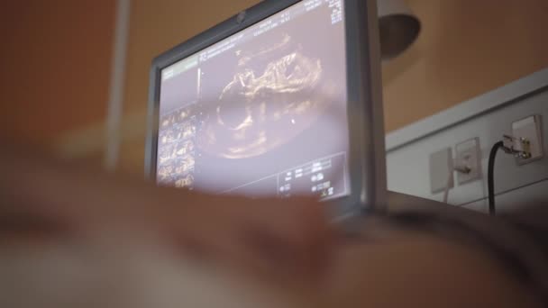 Primer plano de la barriga de una mujer embarazada y el bebé en el monitor de ultrasonido — Vídeos de Stock