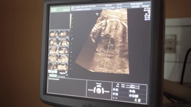 Prise de vue régulière du rythme cardiaque du bébé sur une échographie — Video