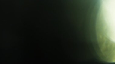 Dijital mercek parlama efekti