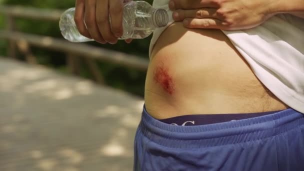 Cycliste blessé verser de l'eau sur le pâturage — Video