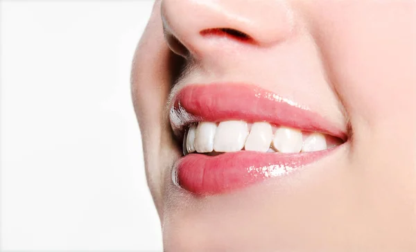 Lachende vrouw mond met grote witte tanden op een witte achtergrond — Stockfoto
