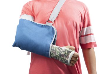 Beyaz arka plan üzerinde izole tedavi için döküm ve askı kullanma kırık kemik kollu adam