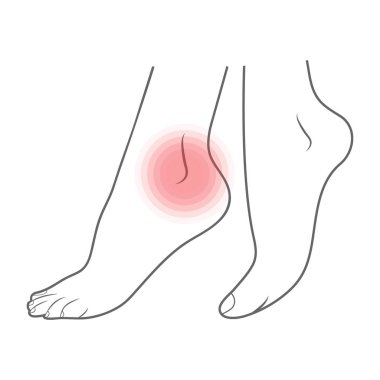 Ayak Biyomekanik, Ayakkabı, Ayakkabı kavramları, tıp, sağlık, Masaj, Spa, akupunktur merkezleri için tek resimde. Beyaz bir arka plan üzerinde izole ağrı kavramı. Vektör çizim.