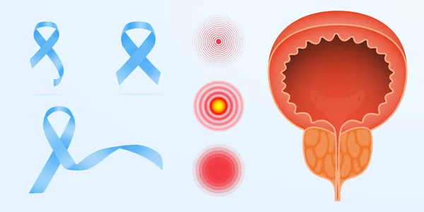 Prostaatkanker kleur pictogram. Mannen s voortplantingssysteem ziekte. Mannelijke onvruchtbaarheid en genitale probleem. Lies pijn. Geïsoleerde vector illustratie, EPS 10 — Stockvector