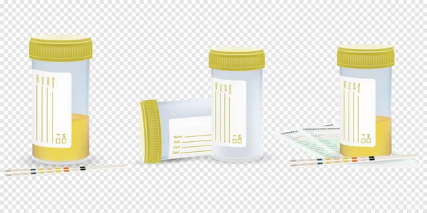 A sample of urine. Laboratory analysis of urine using test strips. Vector illustration set. — Stock Illustration A sample of urine. Laboratory analysis of urine using test strips. Vector illustration set. Royalty Free Stock Illustrations
