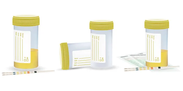 Urine sample set, full and empty containers. Vector illustration