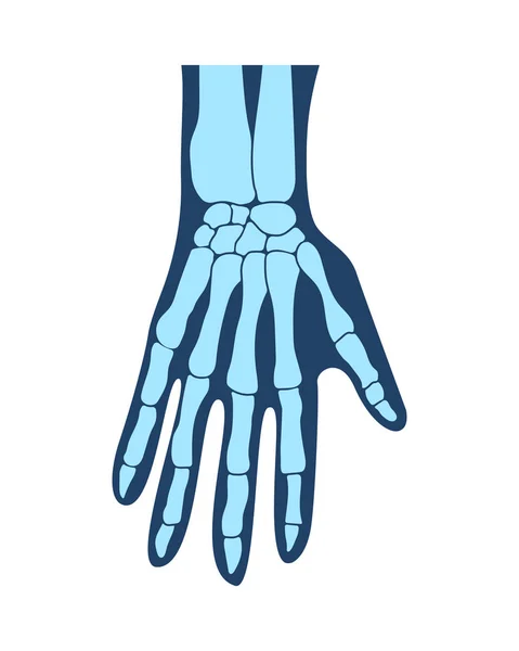 Ossos das mãos, da mão, da estrutura das mãos, da anatomia dos braços, da mão humana. Ilustração vetorial — Vetor de Stock