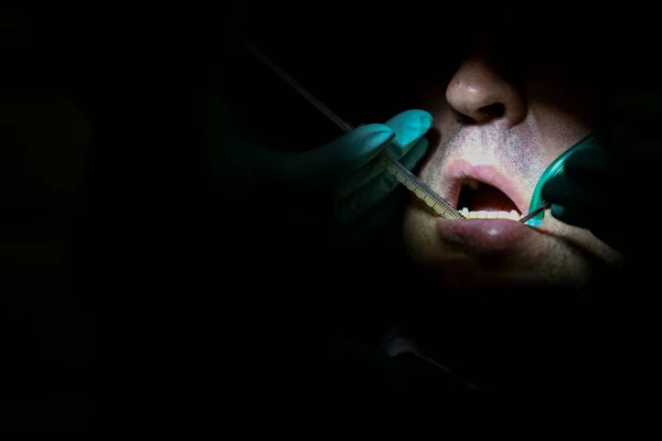 Detaljer Med Hendene Til Kvinnelig Tannlege Med Operasjonshansker Injisering Blodplasma – stockfoto