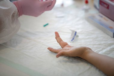 Bükreş, Romanya - 10 Haziran 2020: Hızlı bir Covid-19 Antikor Testi (geçmiş enfeksiyon).