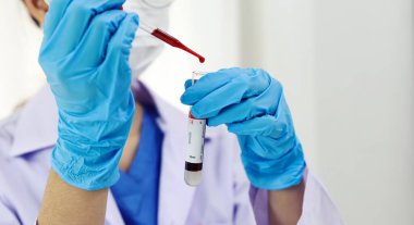 Coronavirus covid-19 'u tutan bilim adamı enfekte olmuş kan örneği tüpü. Kan örneği toplama tüpleri ve şırınga Coronavirus Covid-19 aşı araştırmalarıyla laboratuvardaki kanın DNA testi.
