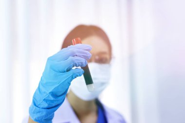 Coronavirus covid-19 'u tutan bilim adamı enfekte olmuş kan örneği tüpü. Kan örneği toplama tüpleri ve şırınga Coronavirus Covid-19 aşı araştırmalarıyla laboratuvardaki kanın DNA testi.