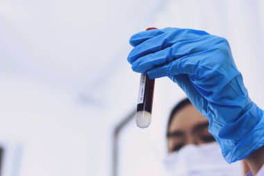 Coronavirus covid-19 'u tutan bilim adamı enfekte olmuş kan örneği tüpü. Kan örneği toplama tüpleri ve şırınga Coronavirus Covid-19 aşı araştırmalarıyla laboratuvardaki kanın DNA testi.