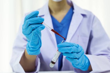 Coronavirus covid-19 'u tutan bilim adamı enfekte olmuş kan örneği tüpü. Kan örneği toplama tüpleri ve şırınga Coronavirus Covid-19 aşı araştırmalarıyla laboratuvardaki kanın DNA testi.