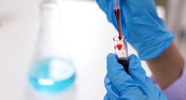 Coronavirus covid-19 'u tutan bilim adamı enfekte olmuş kan örneği tüpü. Kan örneği toplama tüpleri ve şırınga Coronavirus Covid-19 aşı araştırmalarıyla laboratuvardaki kanın DNA testi.