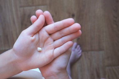 İlk süt dişi düştü. Diş değişikliği konsepti.