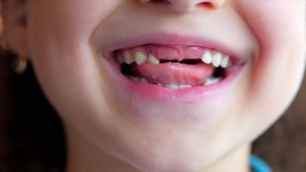 Gros plan d'un sourire de petites filles, dents de bébé. Enfant secoue sa langue Lait dent . — Video