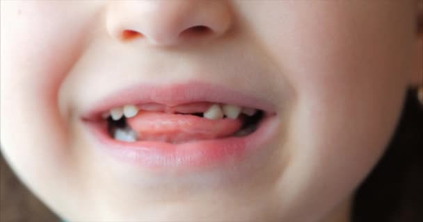 Großaufnahme eines kleinen Mädchens, das lächelt, Baby-Zähne. Kind schüttelt Zunge Milchzahn. — Stockvideo