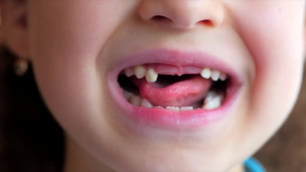 Gros plan d'un sourire de petites filles, dents de bébé. Enfant secoue sa langue Lait dent . — Video