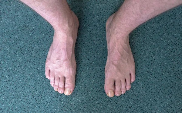 Pieds Nus Vue Dessus Pieds Nus Sur Sol Vert — Photo