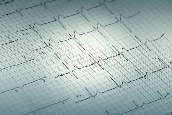 Ecg Paper Graph Report Electrocardiogram Paper Form Background — Stock Photo, Image