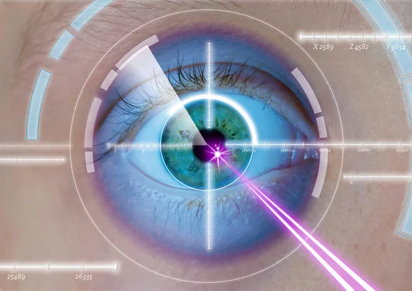 Chirurgia Laser Dell Occhio Diottria Occhio Laser Correzione — Foto Stock