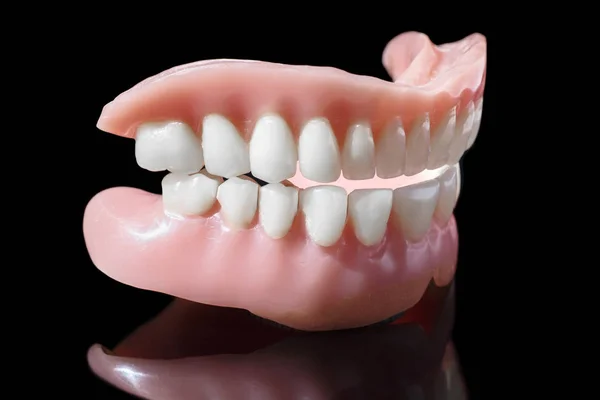 Dentiera Medica Sorriso Mascelle Denti Vicino Isolato Sfondo Nero — Foto Stock