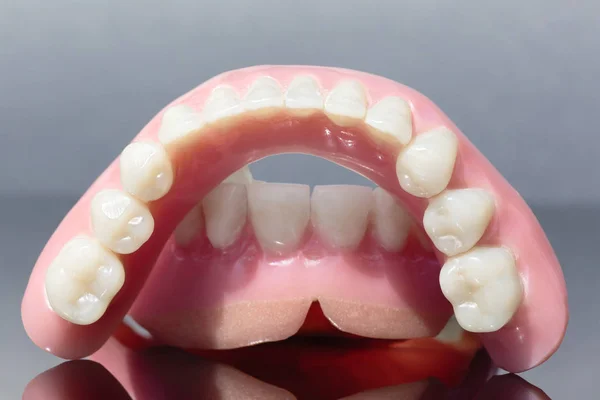 Medyczne Protezy Zębów Szczęki Białym Tle Szarym Tle — Zdjęcie stockowe