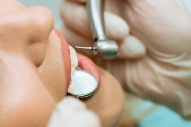 bir diş hekimi ile bir resepsiyonda. muayene, diş hekimi. Diş dolgu. güzel gülümseme