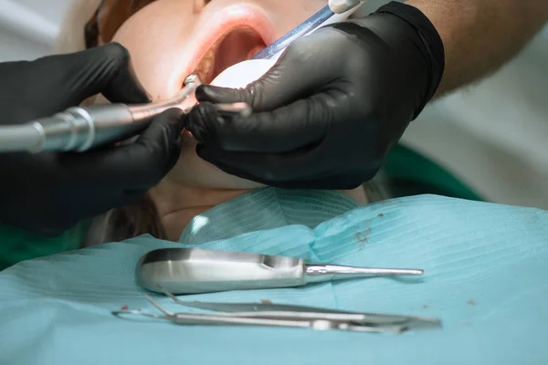 extraction of teeth. dental office