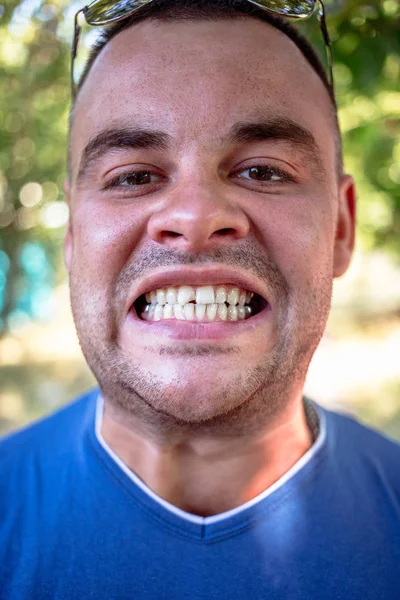 Hombre Joven Con Una Camiseta Azul Con Diente Astillado — Foto de Stock