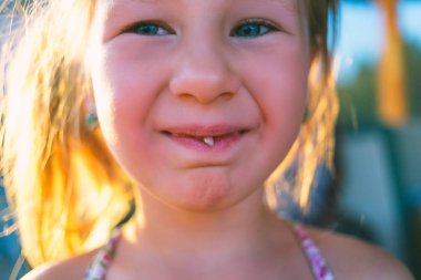 Uzatılmış süt dişli küçük bir kızın portresi..